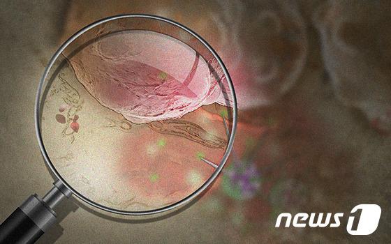 위암 검진, 지금 받자…조기 발견만이 오래 살 길