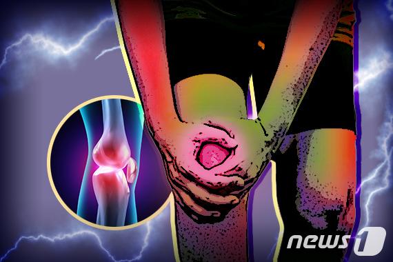 "무릎관절염, 한의치료로 수술 및 고위험 진통제 사용 줄인다"