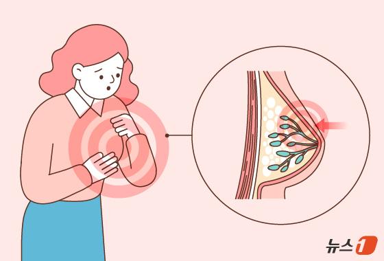 "살만하면 다시 죽어가"…박미선이 싸우는 유방암, 생존율은?