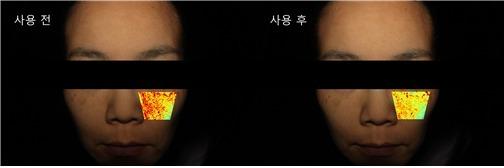 모아라이프플러스 "'닥터스피지에이 로즈엑소부스터', 미백 효능 임상 입증"