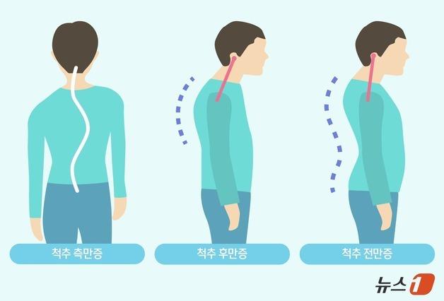 '굽은 등' '휜 허리' 척추가 보내는 조기 신호는