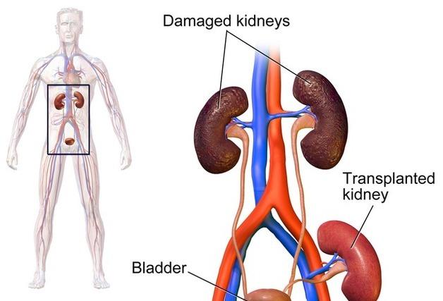 김정한의 역사&오늘