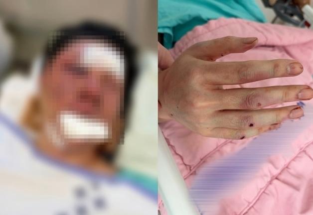 "내 아들, 그런 애 아냐"…유튜버 수탉 납치범母 항변