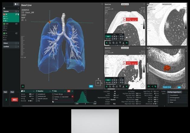 코어라인소프트, 호주 발판 삼아 성장기 진입…성장 곡선 본격화
