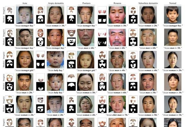 서울대병원 연구진, 인종 편향 없앤 의료용 안면 익명화 AI 개발