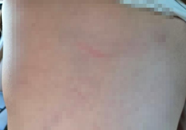 장애아동 학대해도 다시 '선생님'으로…제도 사각지대 언어재활사