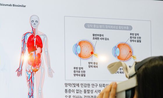 'VR로 황반변성 질환 증상 체험'