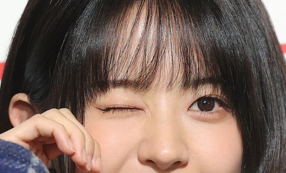 전소영, 윙크에 녹네녹아