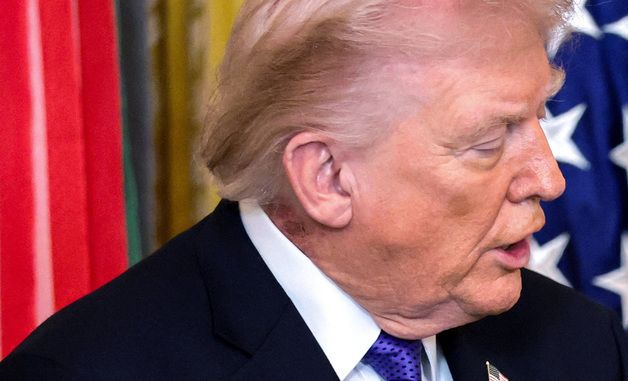 [포토] 트럼프 목덜미 '울긋불긋' 잡티 포착