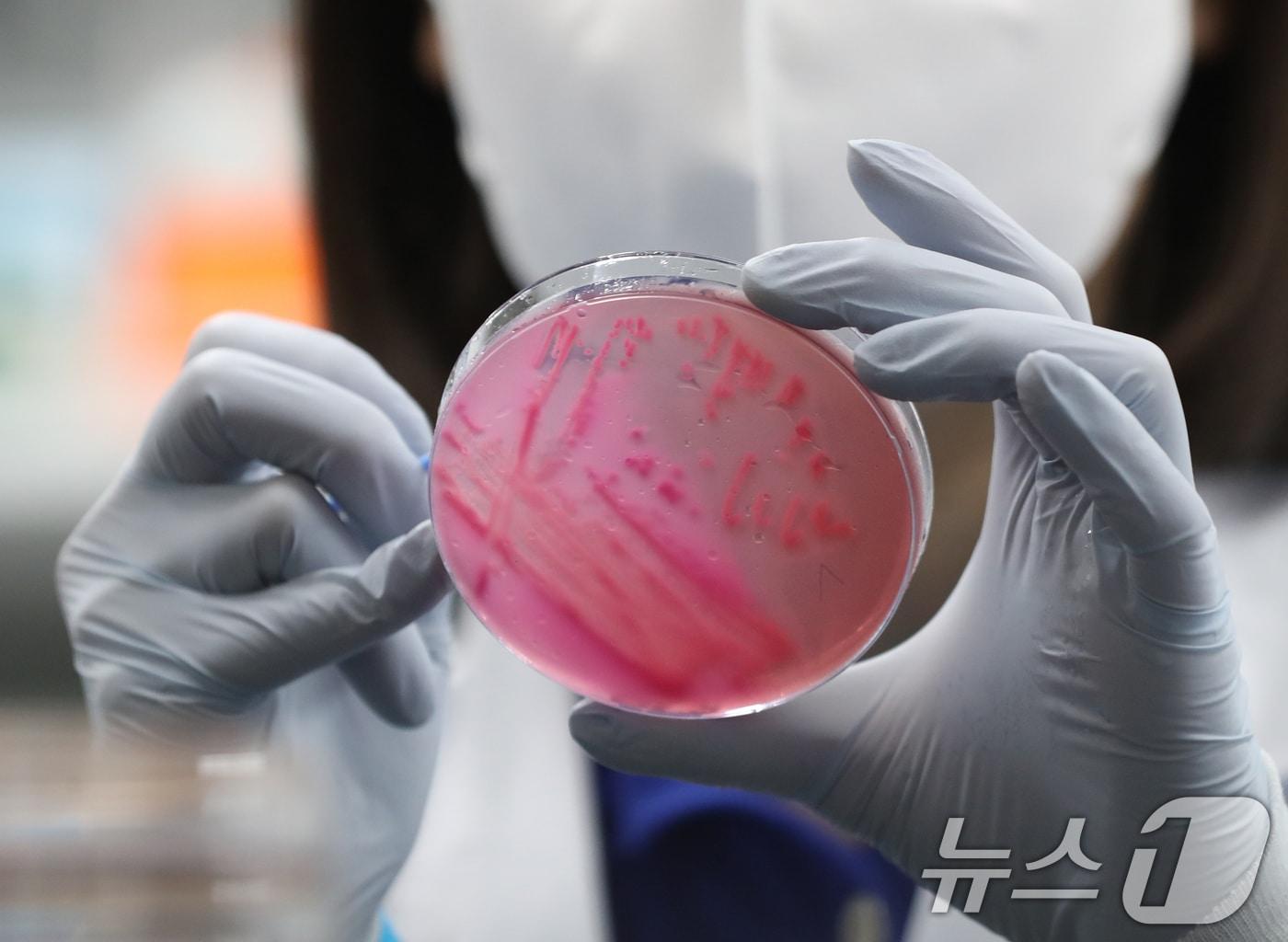 본문 이미지 - 더운 여름철 날씨에 식중독 위험성이 높아지고 있는 가운데 19일 오전 경기 수원시 권선구 경기도보건환경연구원에서 감염병연구부 수인성질환팀 직원이 식중독균 배양검사를 하고 있다. 2024.6.19/뉴스1 ⓒ News1 김영운 기자